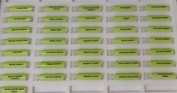 Test enfermedades higado y vesícula biliar